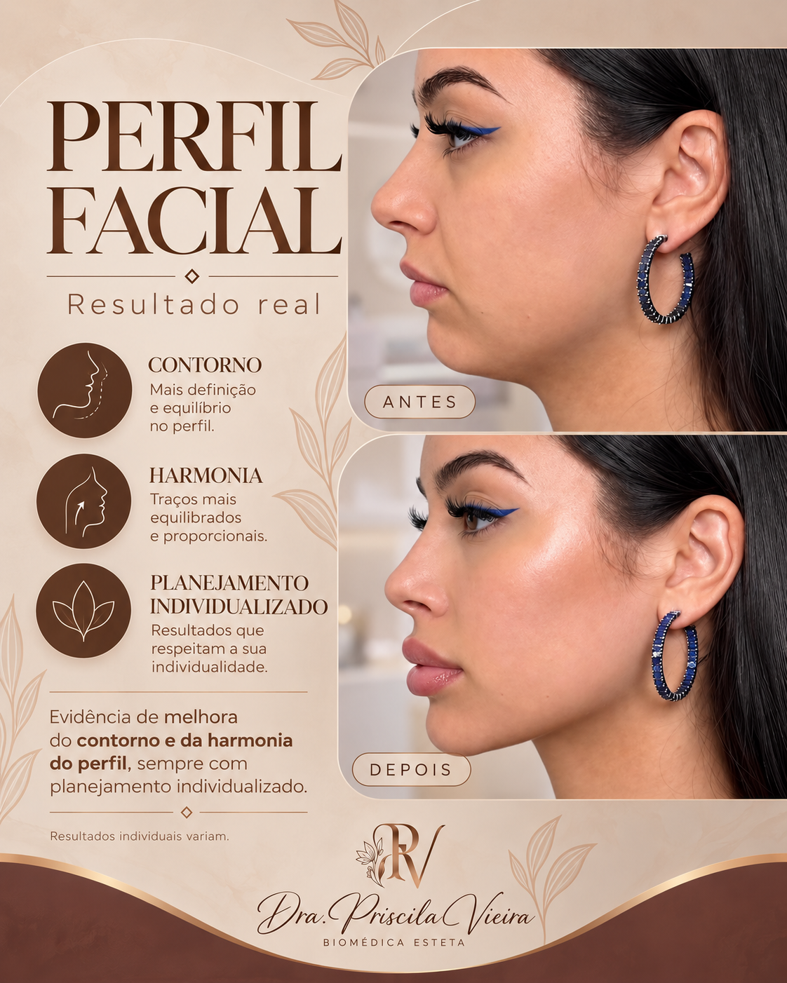 Cartão de resultado real de perfil facial com antes e depois