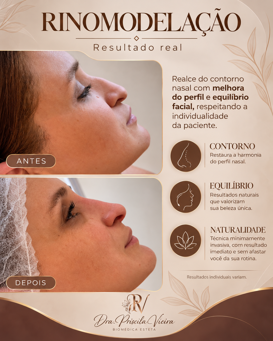 Cartão de resultado real de rinomodelação com antes e depois